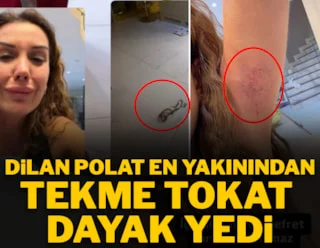 Dilan Polat en yakınından tekme tokat dayak yedi